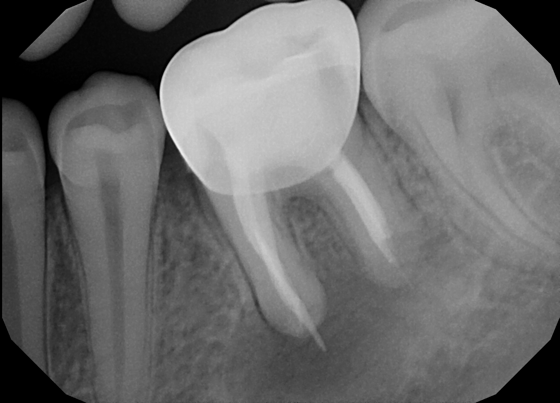 Dental X Rays The Whole Tooth Pediatric Dental Blog