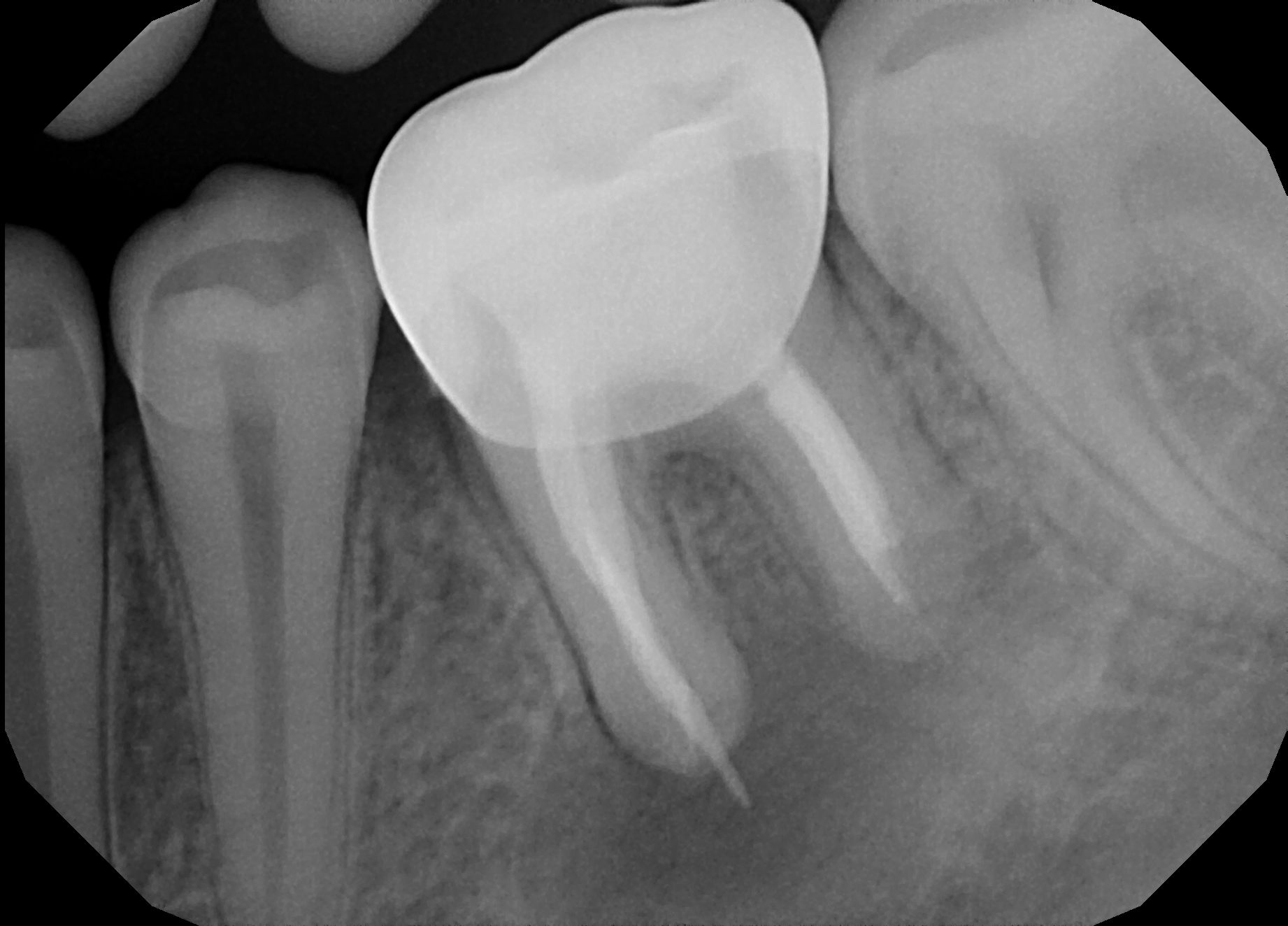 Dental X-Rays: The Whole Tooth – Pediatric Dental Blog