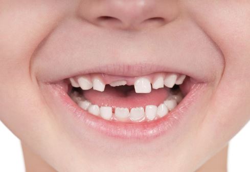 Eruption Patterns Pediatric Dental Blog